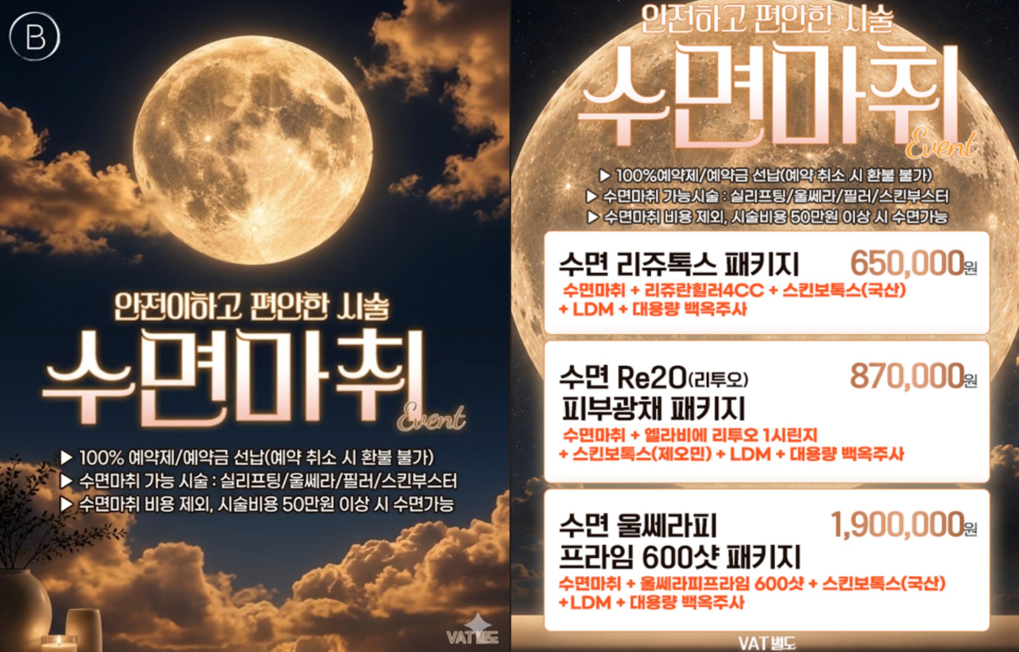 수면마취