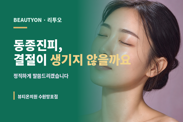 뷰티온의원 수원망포점 :: 동종진피 시술, 결절이 생기지 않을까요