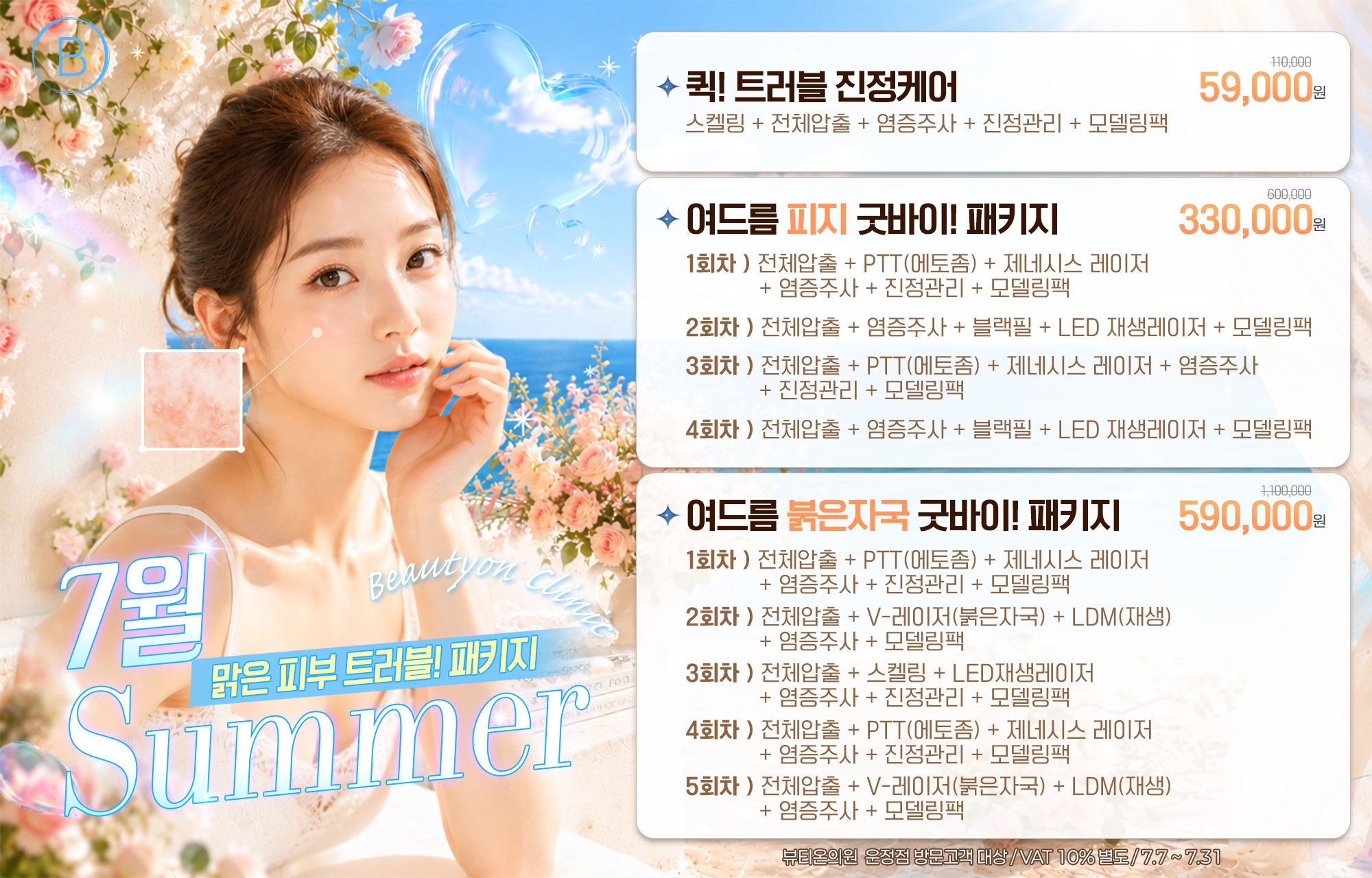 뷰티온의원 파주운정점 :: 🐳여름 Summer 트러블 관리 패키지🐳
