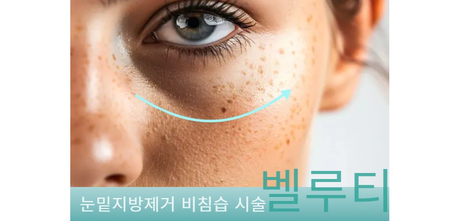 뷰티온의원 파주운정점 :: 벨루티 레이저