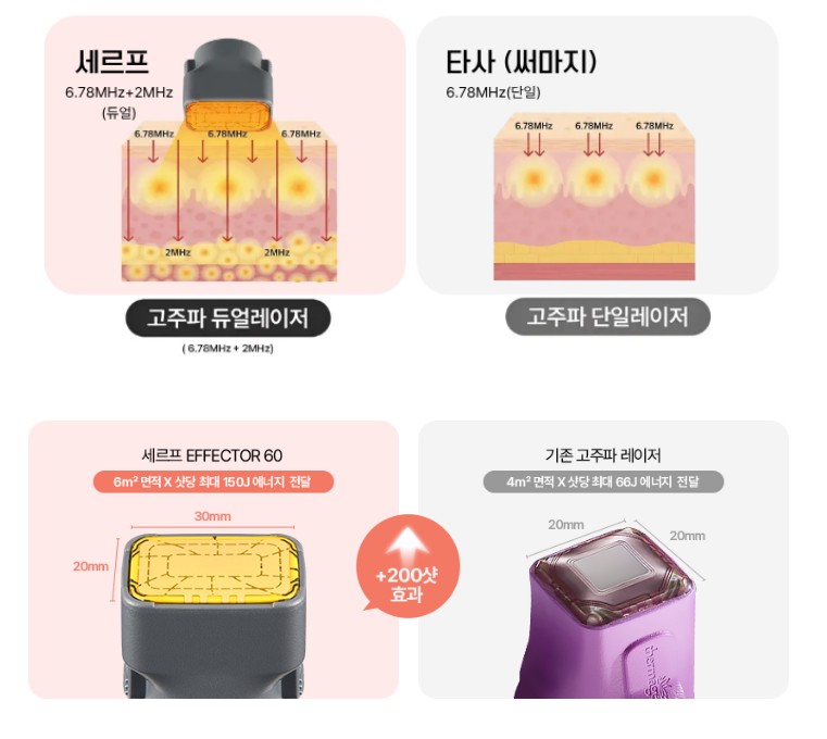 뷰티온의원 파주운정점 :: 세르프 리프팅