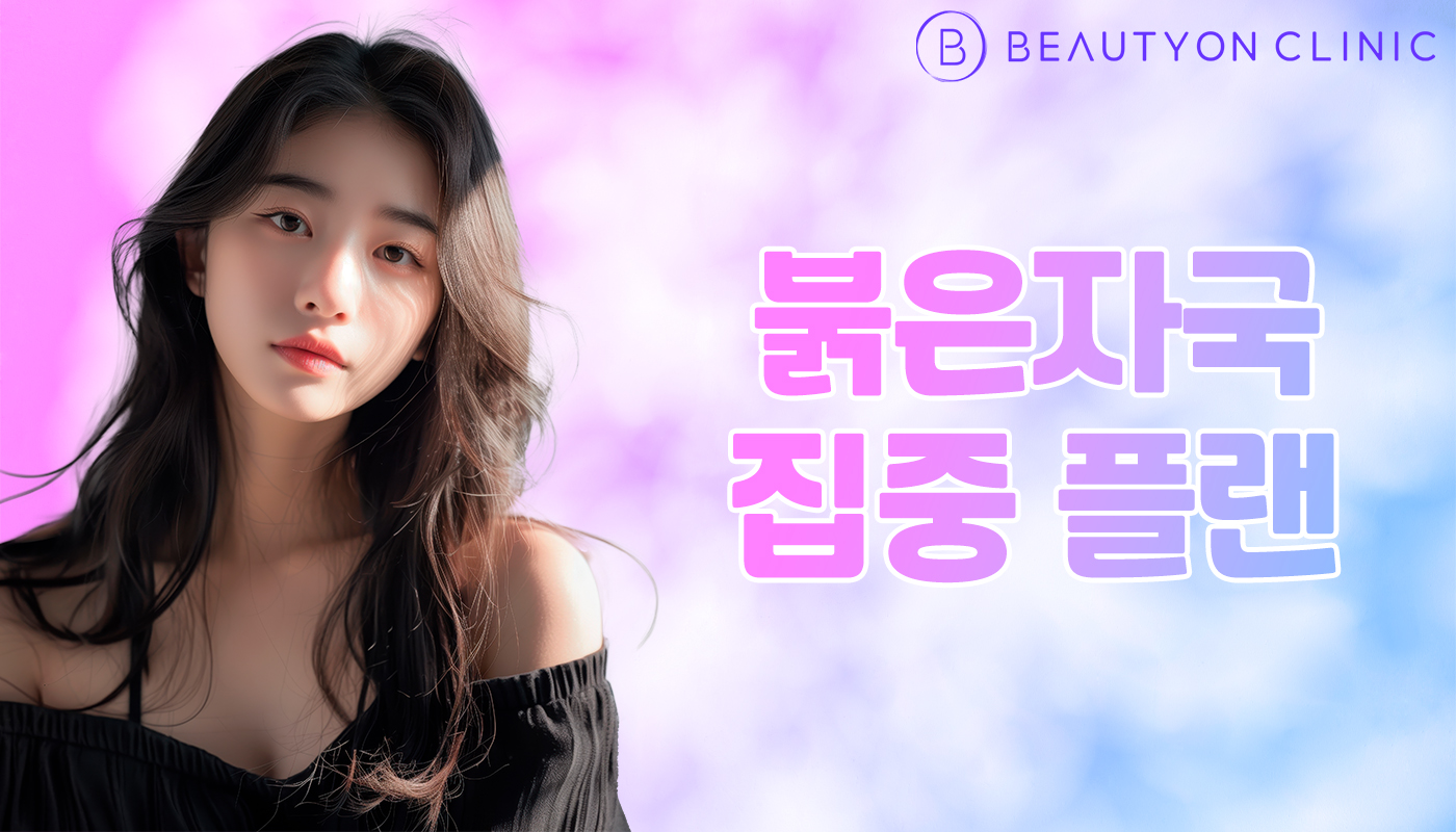 뷰티온의원 안양범계점 :: 붉은 자국 집중 플랜