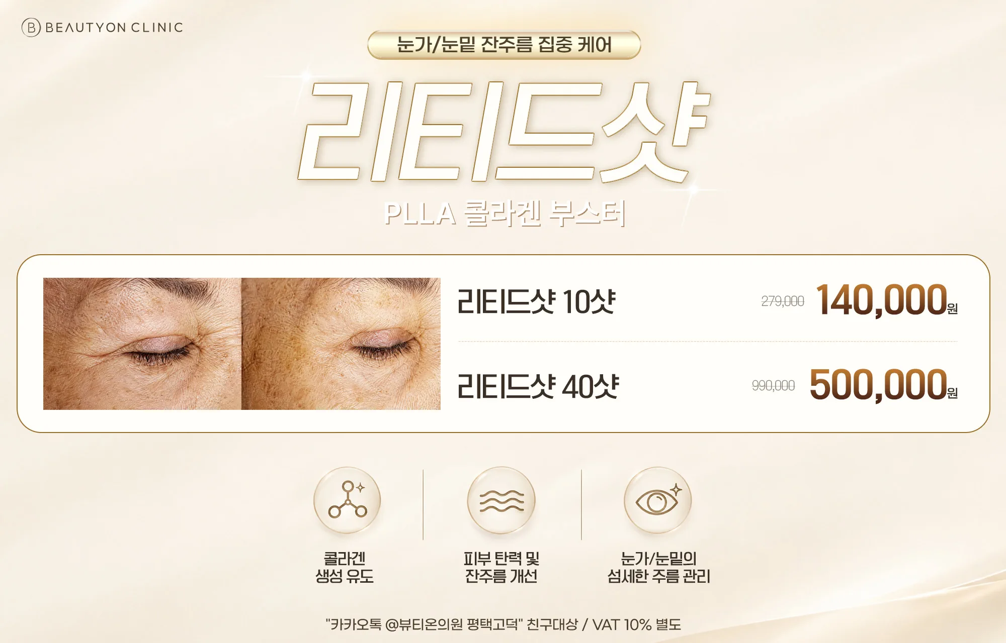 ✨리티드샷 런칭