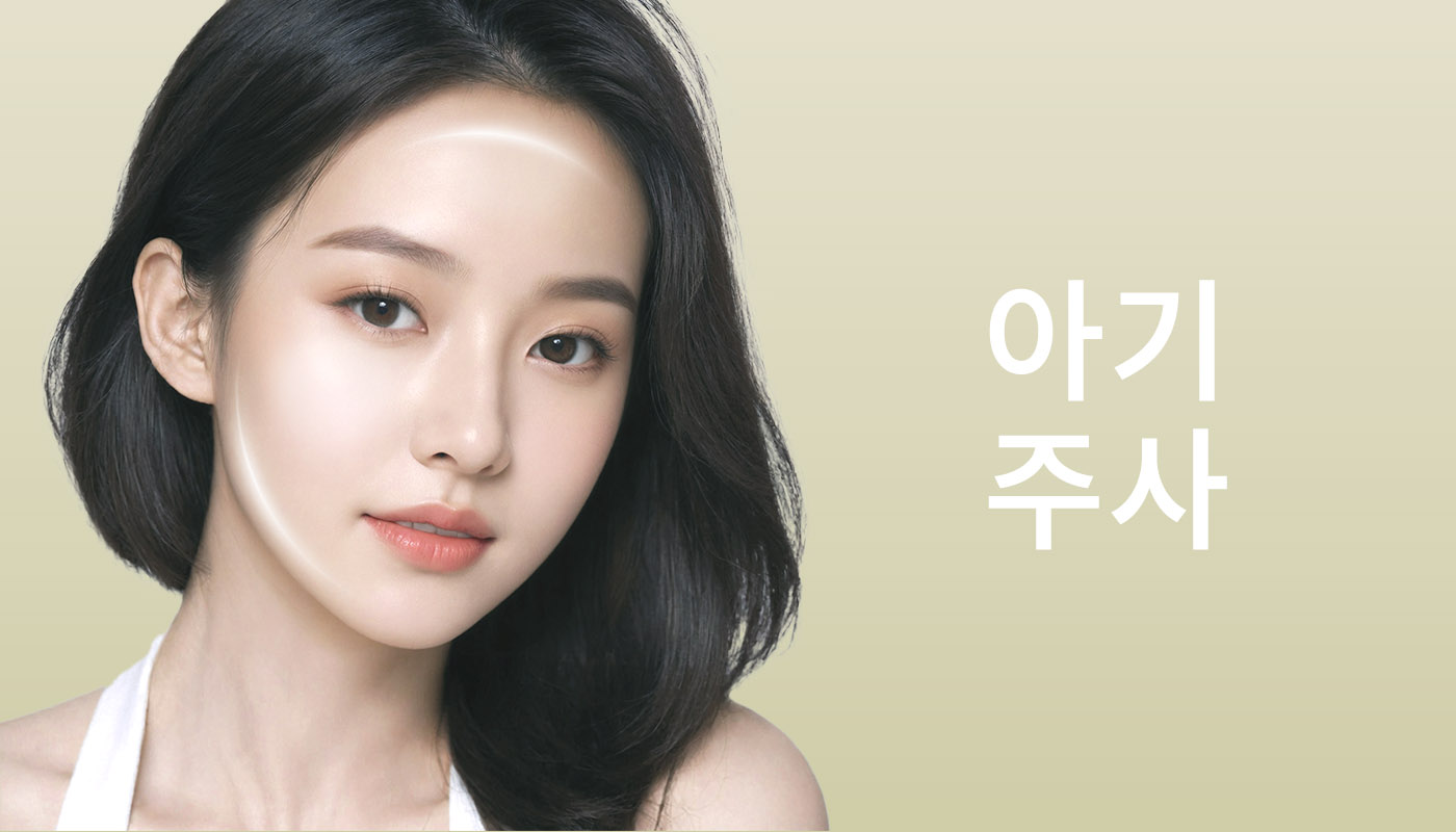 뷰티온의원 별내점 :: 아기주사(MTS)