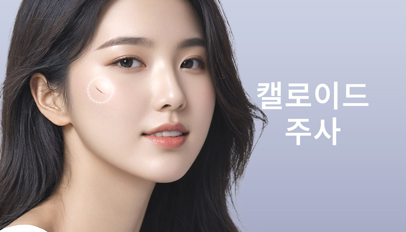 뷰티온의원 별내점 :: 켈로이드 주사 