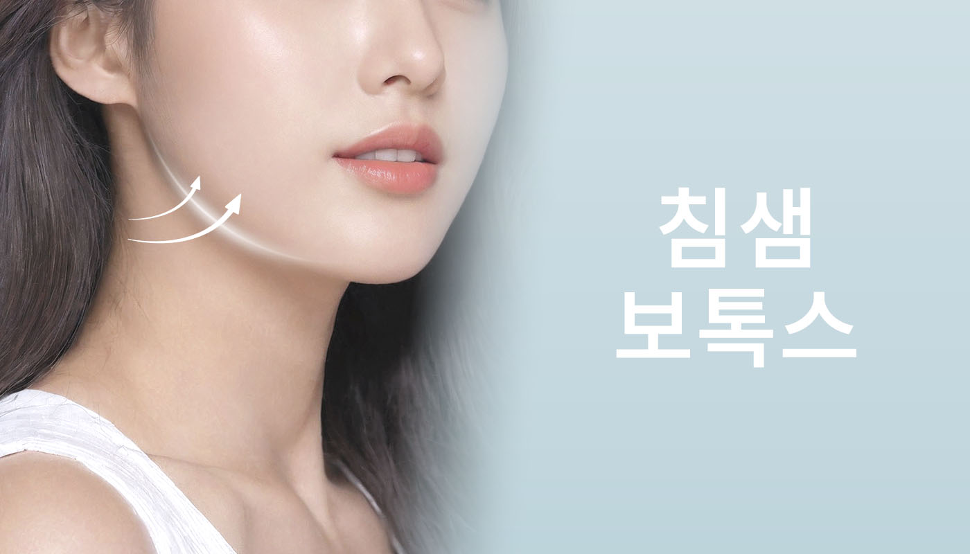 뷰티온의원 성남신흥점 :: 침샘보톡스
