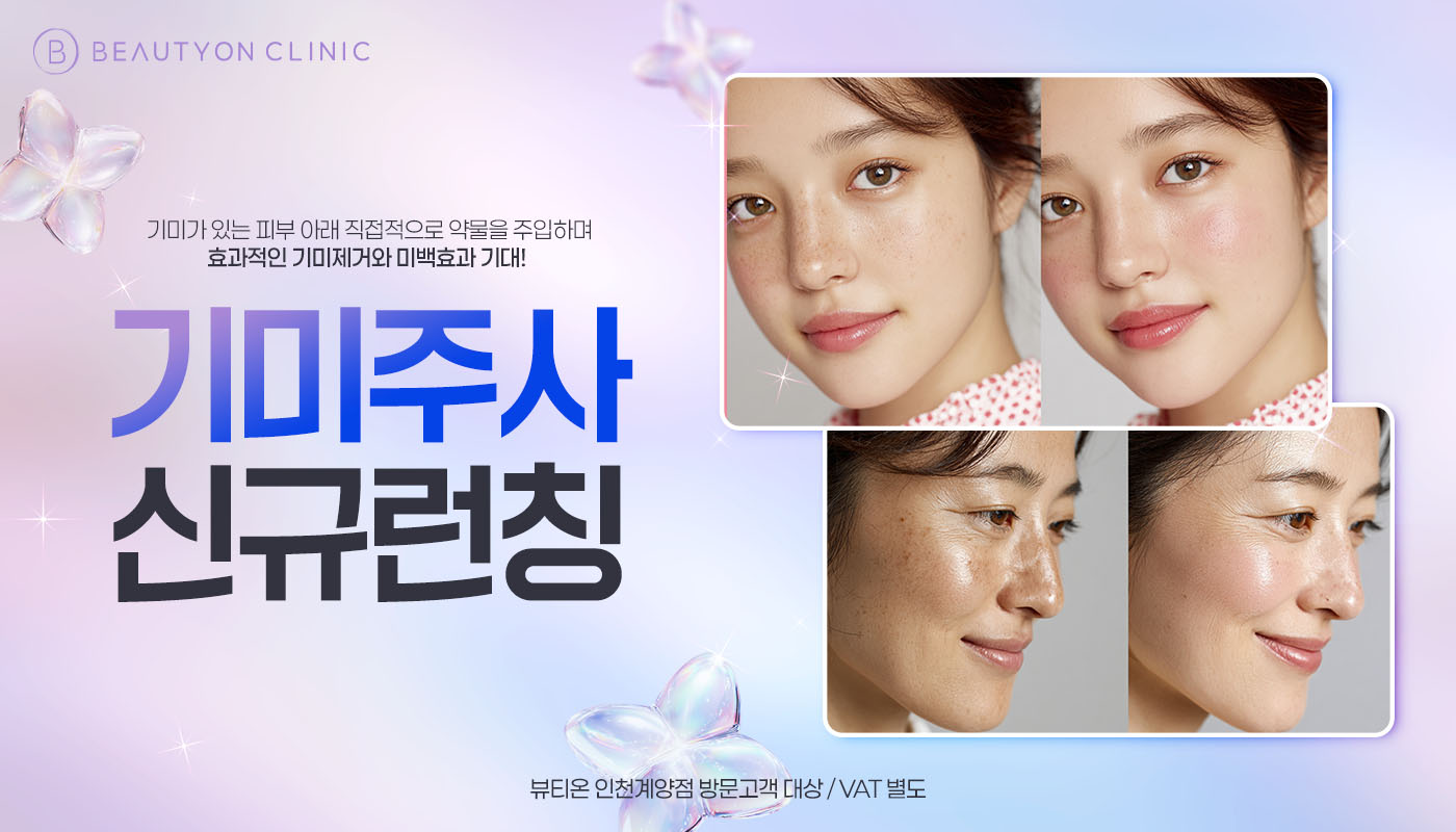 인천계양 뷰티온의원 :: 기미주사