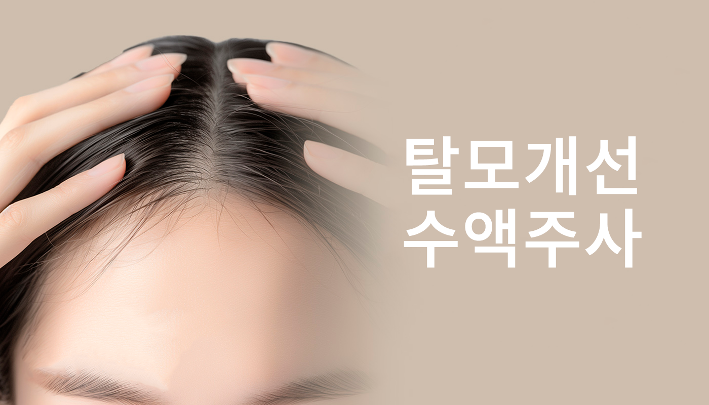 대전도안 뷰티온의원 :: 탈모개선 수액주사 