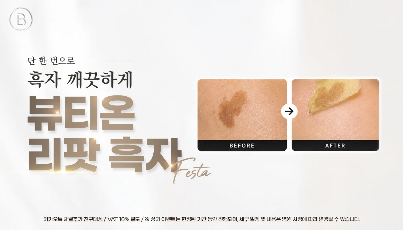 대전피부과 뷰티온의원 대전도안점ㅣ피부 리프팅 보톡스 상담 :: 뷰티온 흑자 리팟 페스타