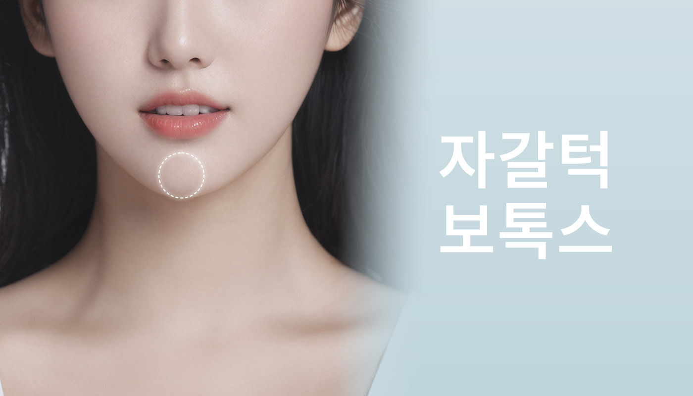 대전도안 뷰티온의원 :: 자갈턱 보톡스
