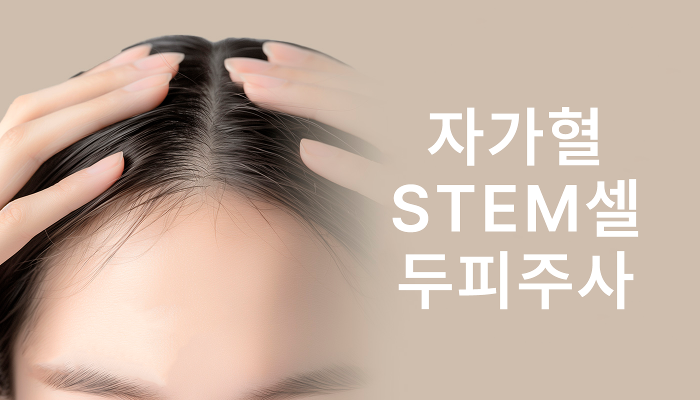 대전도안 뷰티온의원 :: 자가혈STEM셀 두피주사