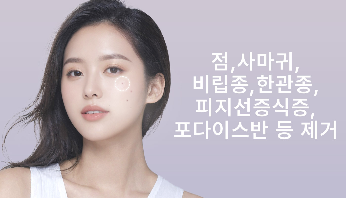 대전도안 뷰티온의원 :: 점/사마귀/비립종/한관종/피지선증식증/포다이스반 제거
