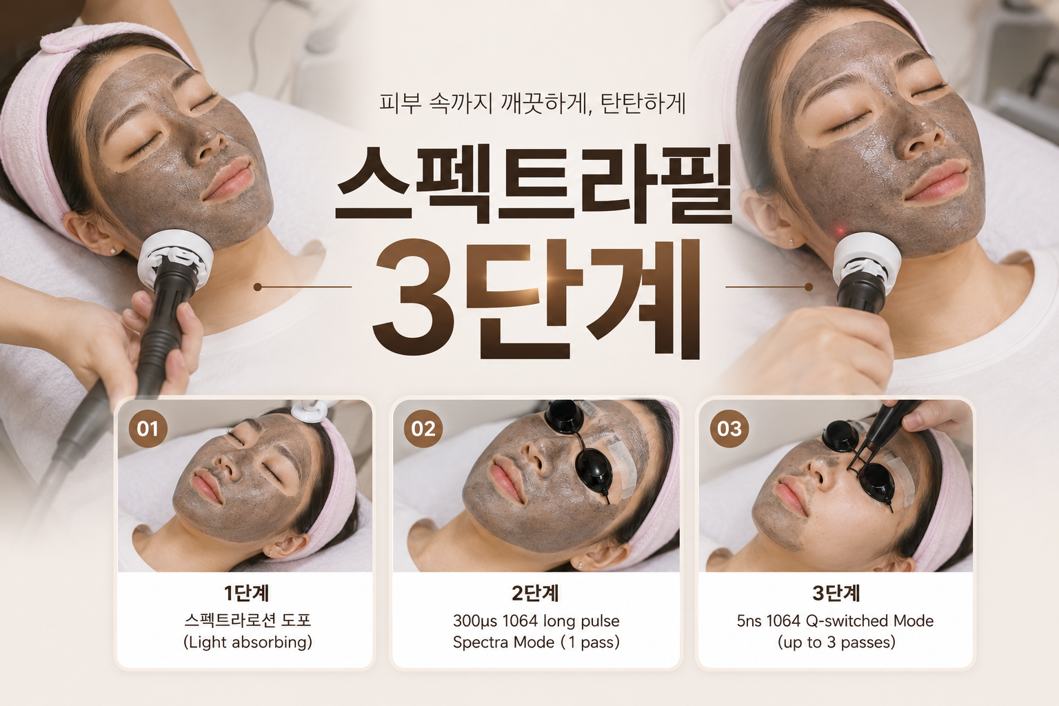 대전도안 뷰티온의원 :: 스펙트라필토닝 3단계