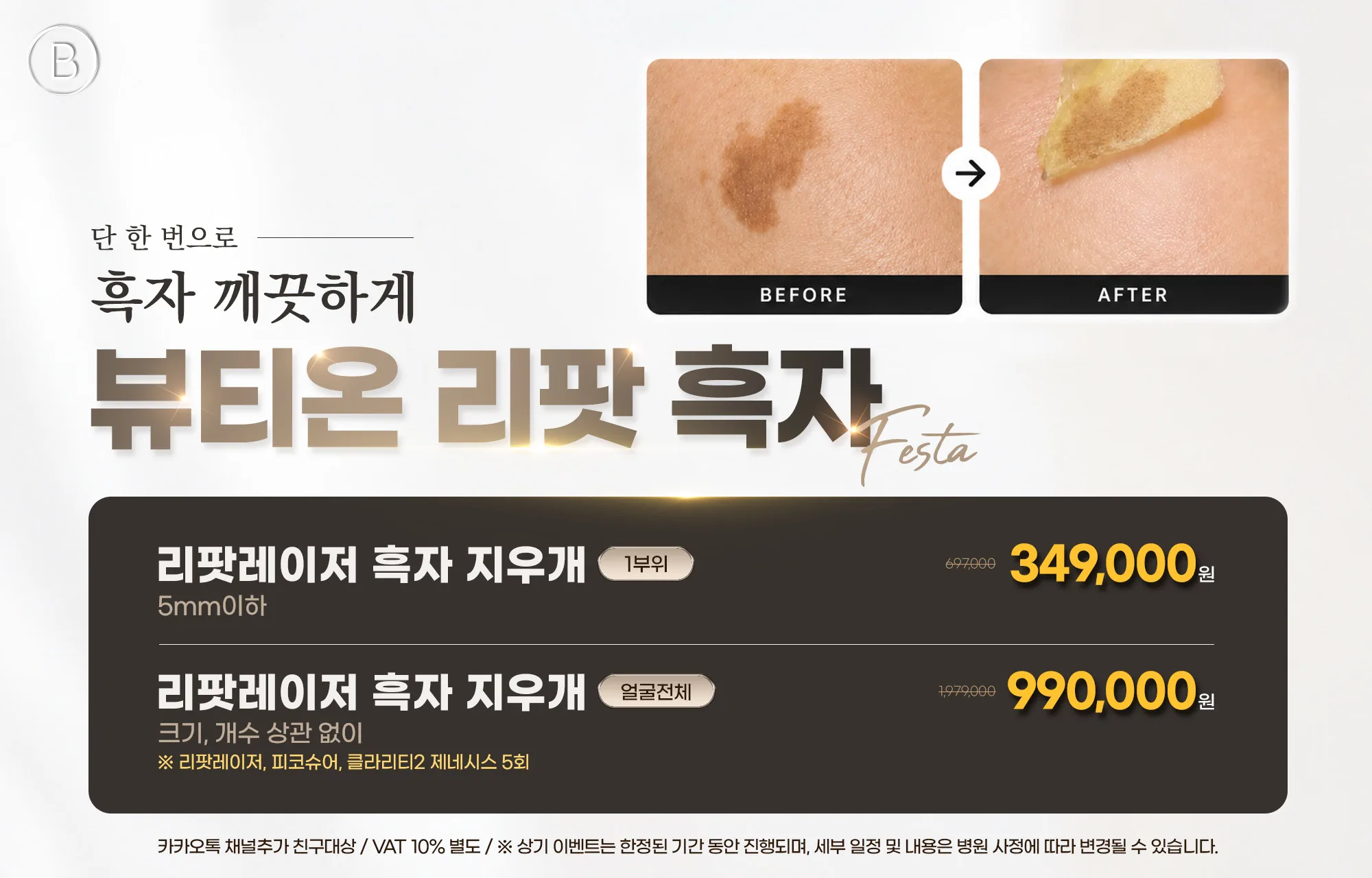 리팟레이저 흑자 제거 패키지