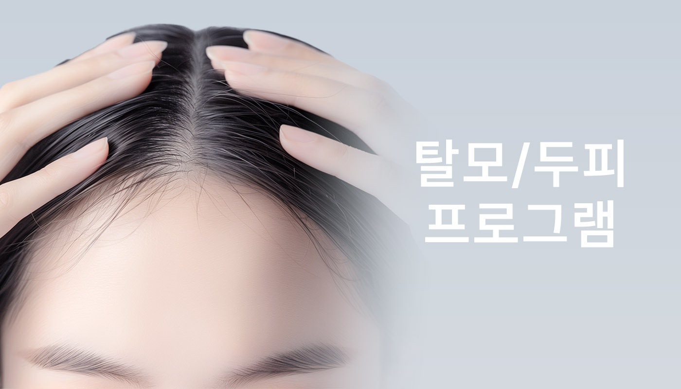 대전도안 뷰티온의원 :: 탈모/두피 프로그램