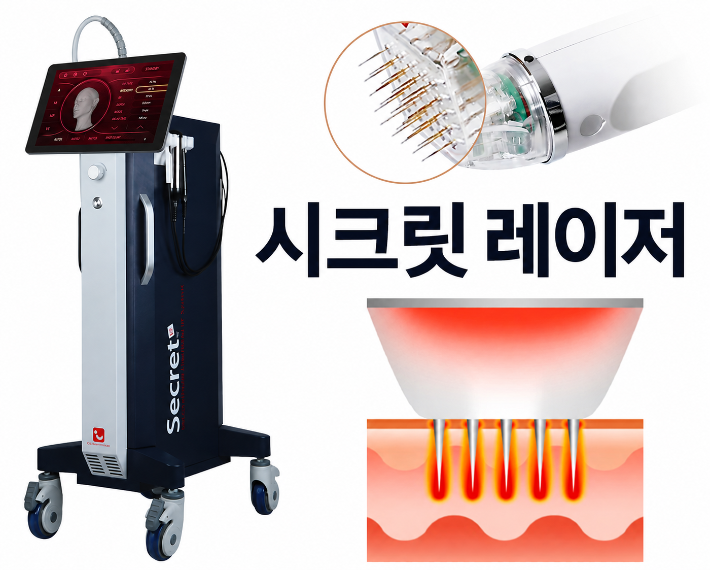 대전도안 뷰티온의원 :: 시크릿 홍조