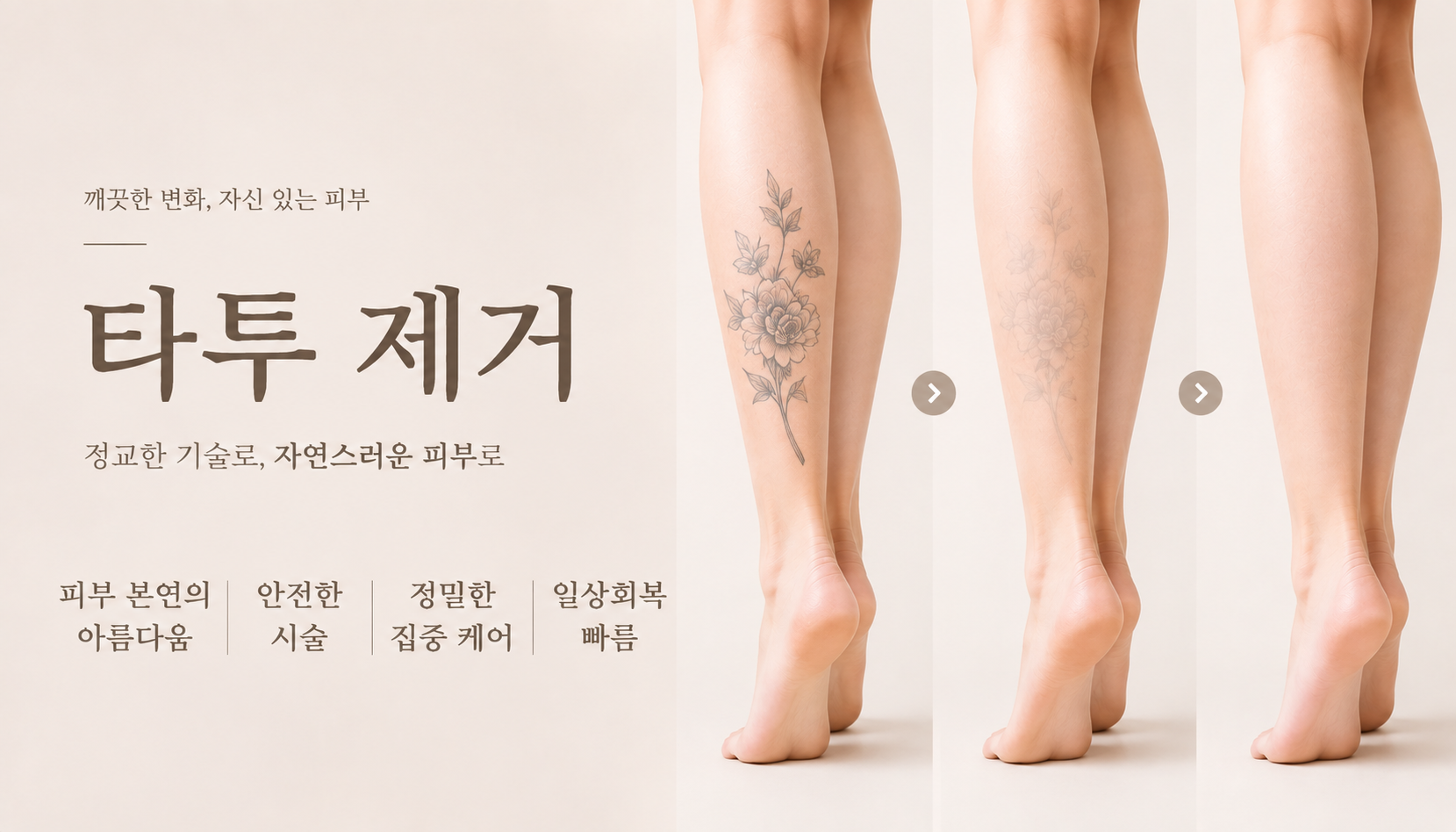 뷰티온의원 통영점 :: 피코 문신제거 5회 패키지