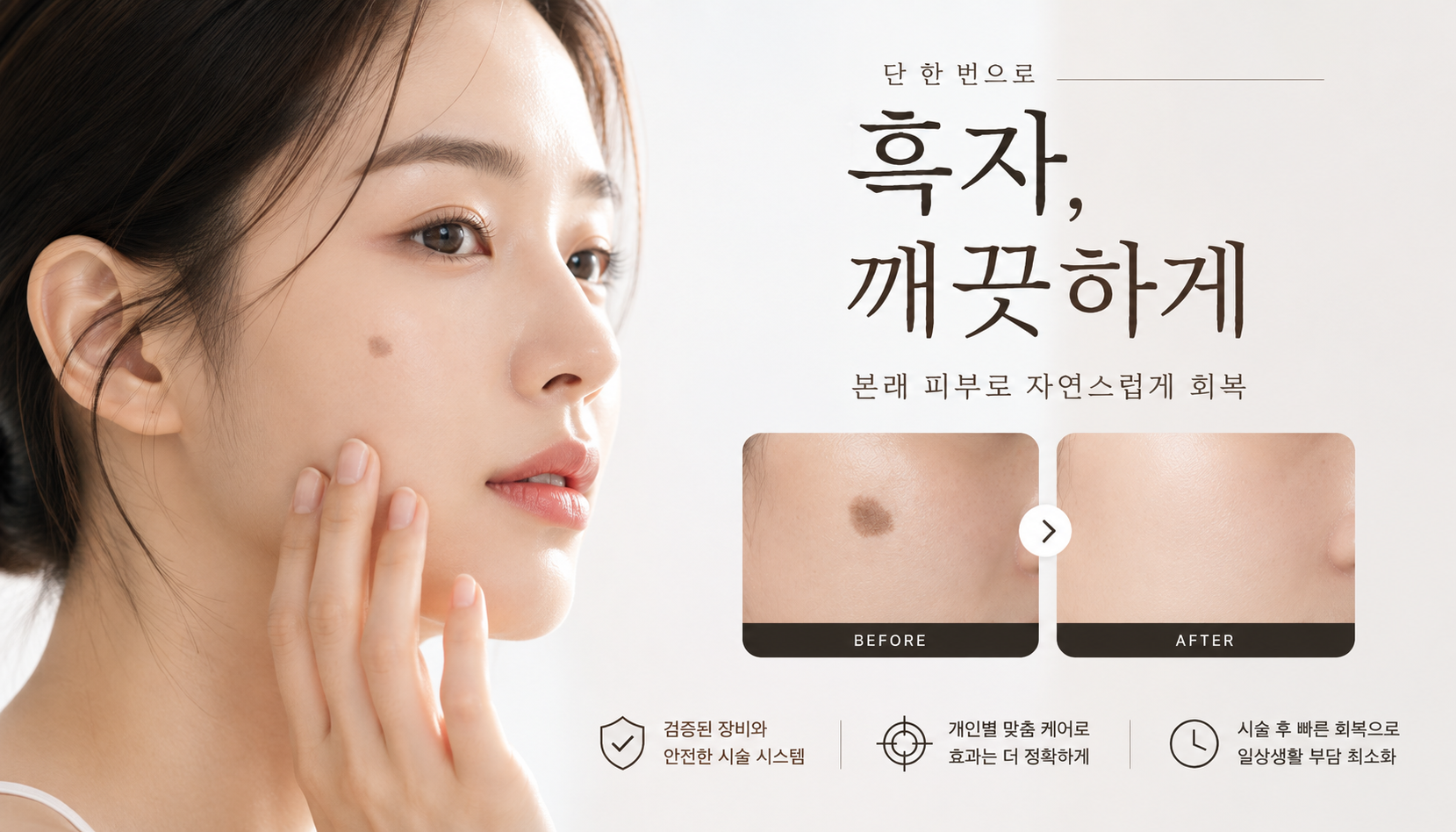 뷰티온의원 통영점 :: 시그니처 흑자 지우개
