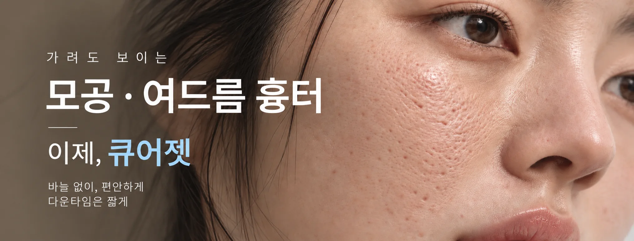 뷰티온의원 오산점