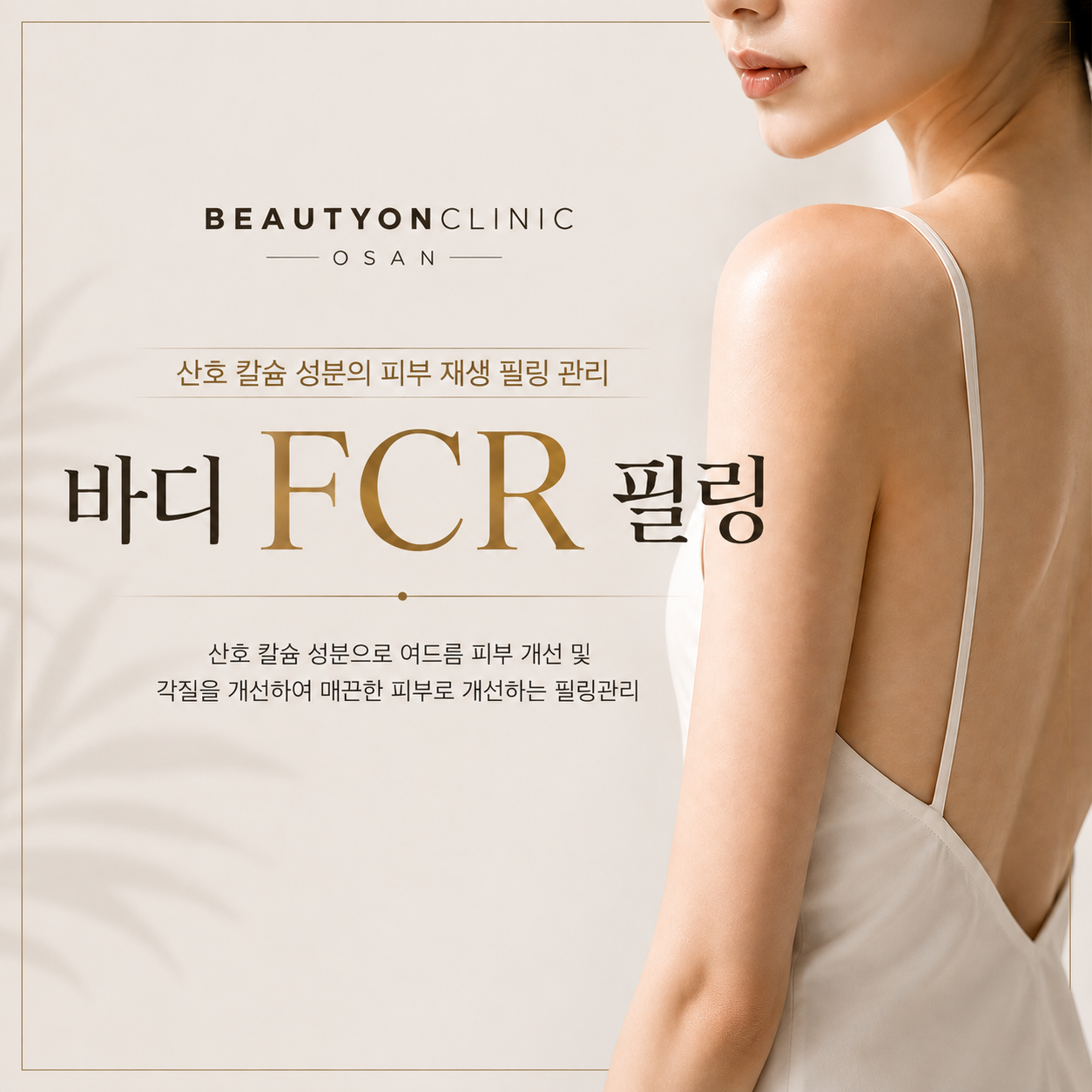 FCR