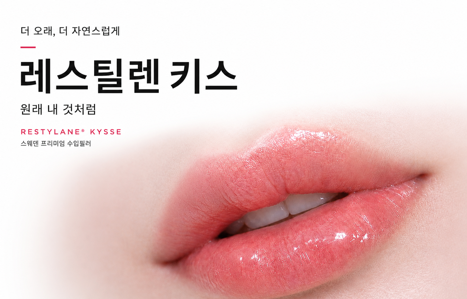 레스틸렌키스 런칭