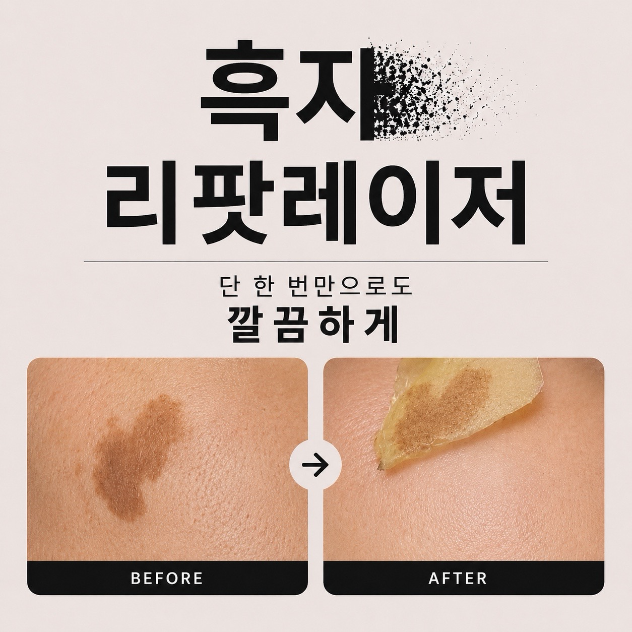 리팟