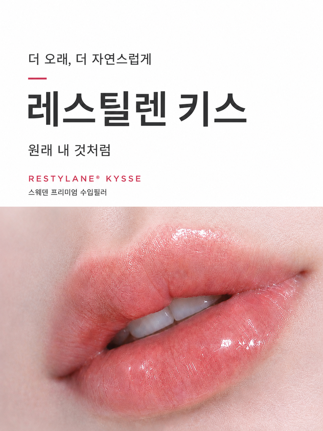 레스틸렌키스 런칭