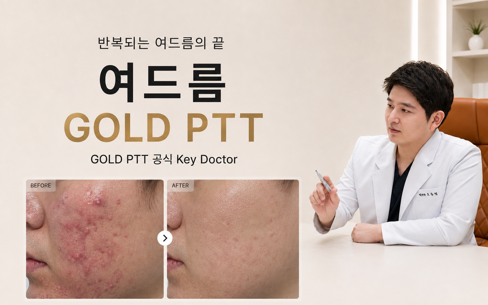 뷰티온의원 오산점 :: 여드름 완결판 GOLD PTT
