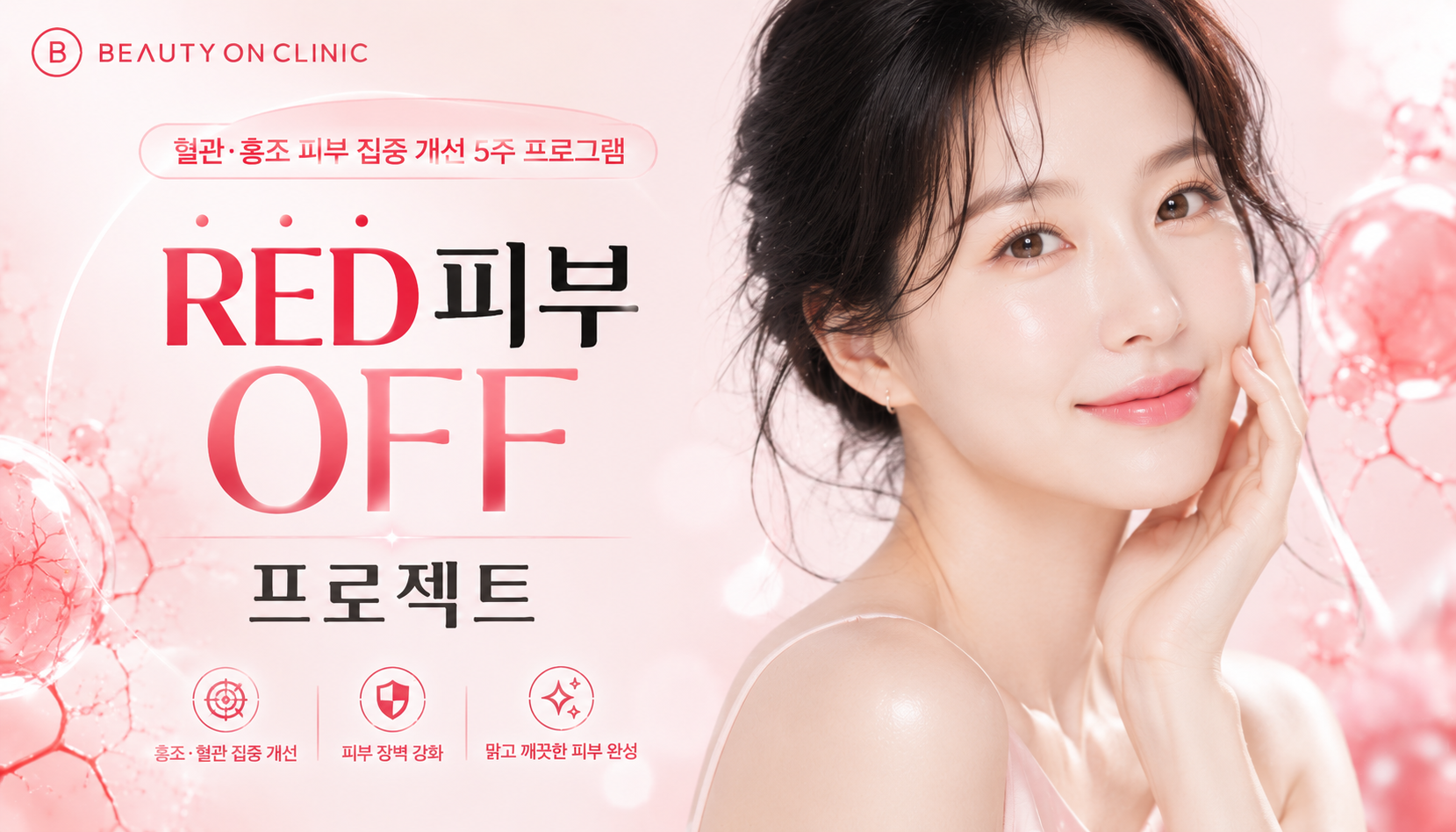 부천소사뷰티온의원 :: 💕RED OFF 프로젝트