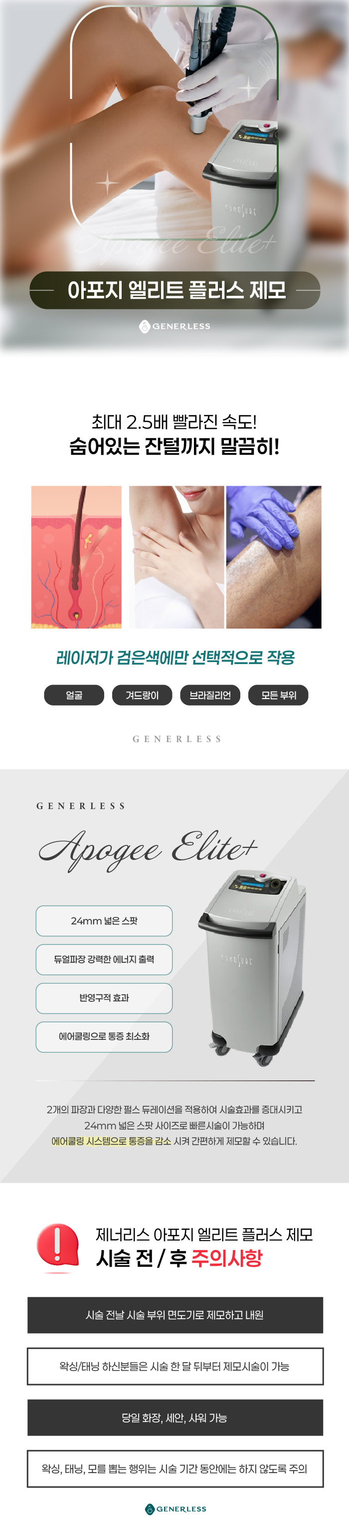 연신내피부과 :: [여성]얼굴제모