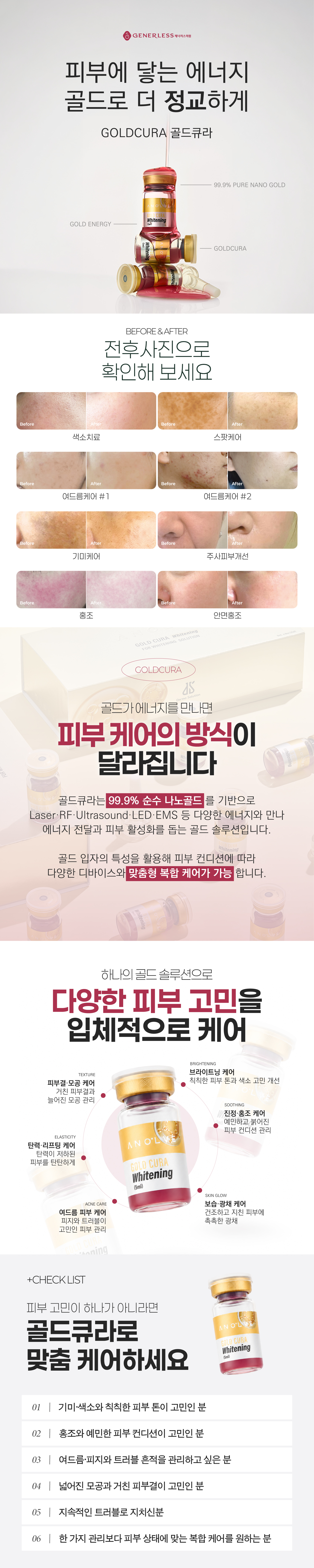 연신내피부과 :: 골드 큐라 LDM