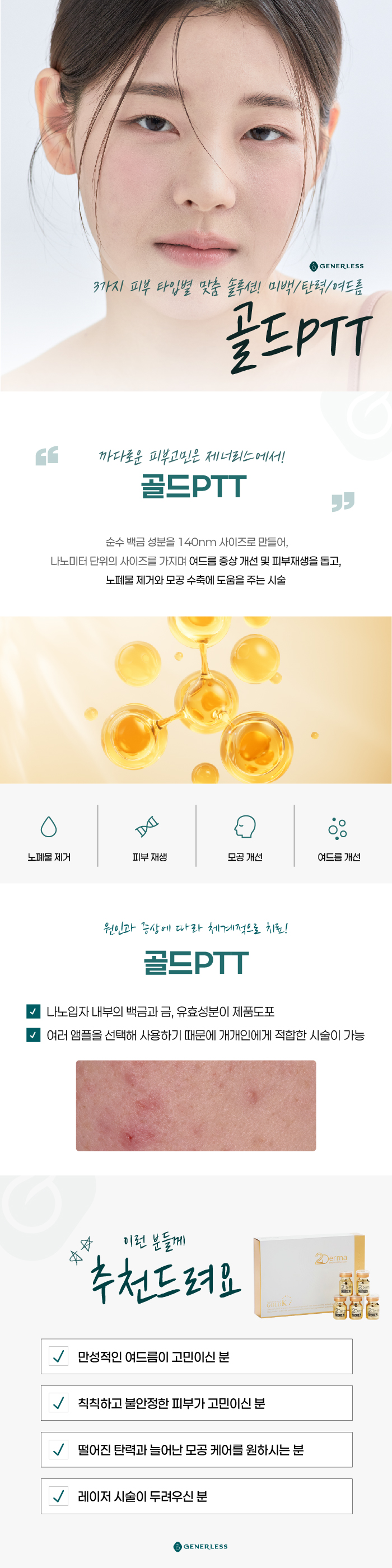 연신내피부과 :: 골드PTT