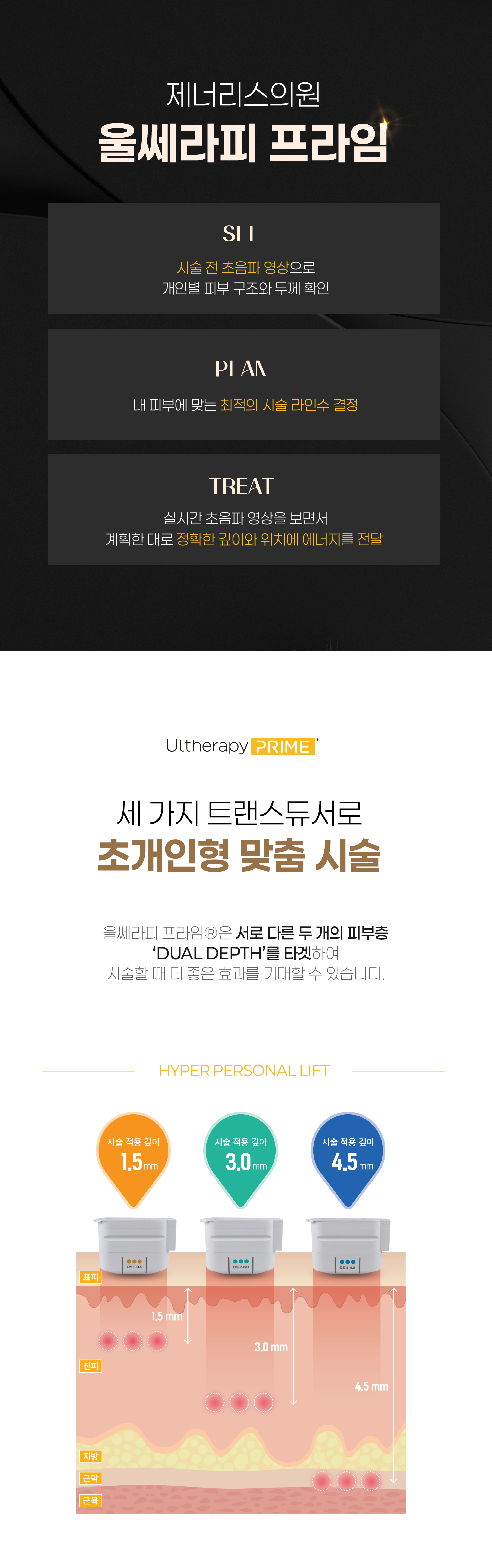연신내피부과 :: 울쎄라피 프라임 리프팅