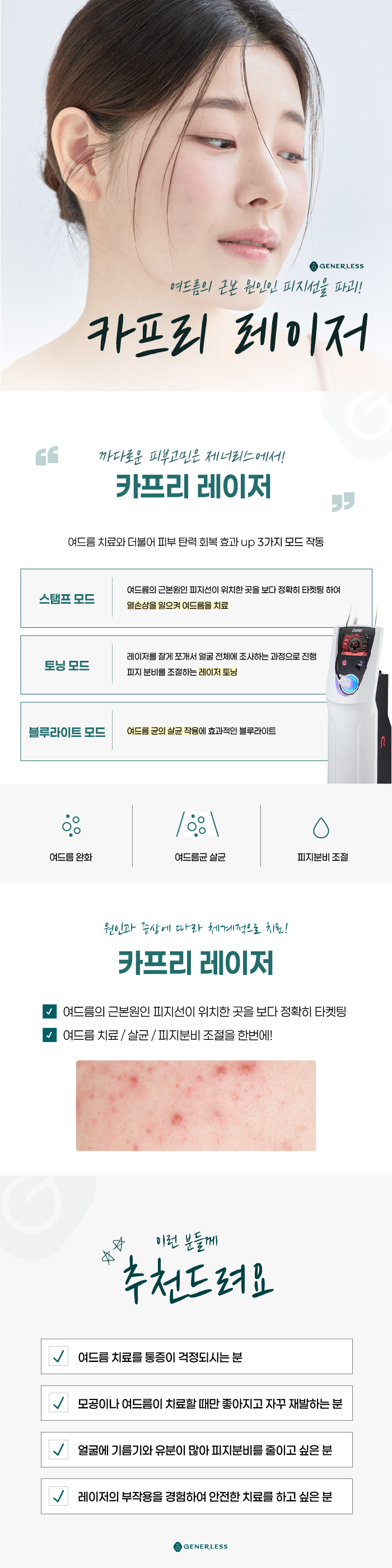 연신내피부과 :: 카프리 레이저