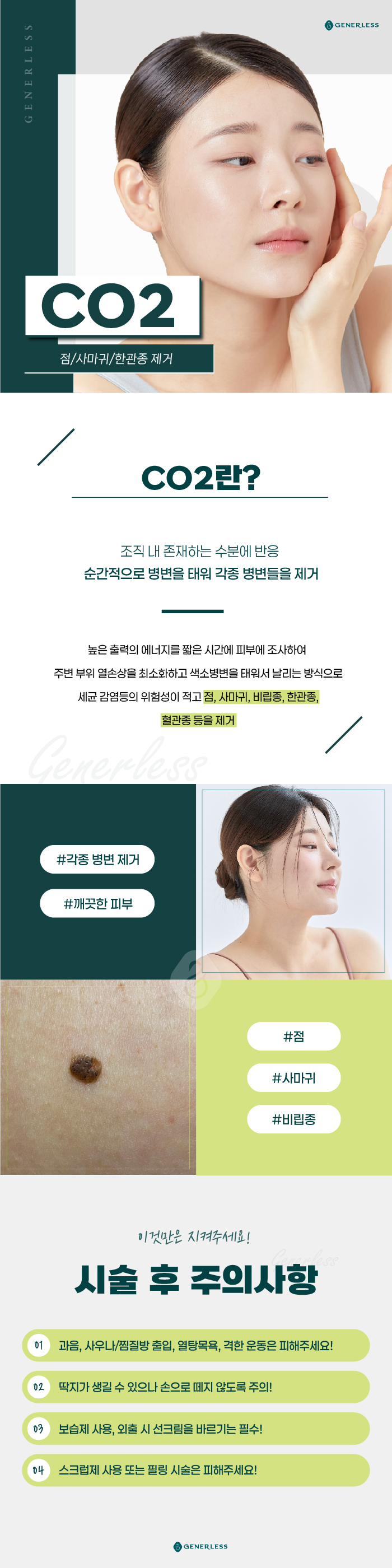 연신내피부과 :: CO2
