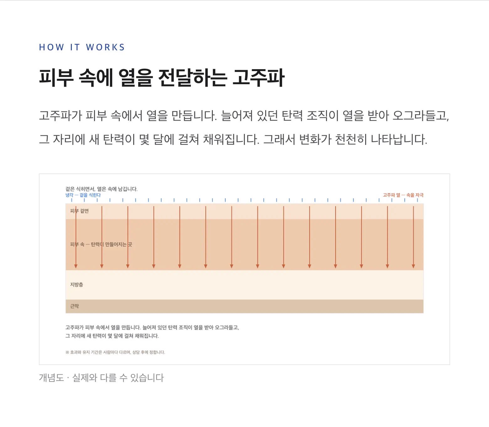 콜라겐을 아는 피부과 디에스타의원ㅣ광교피부과 :: 텐써마