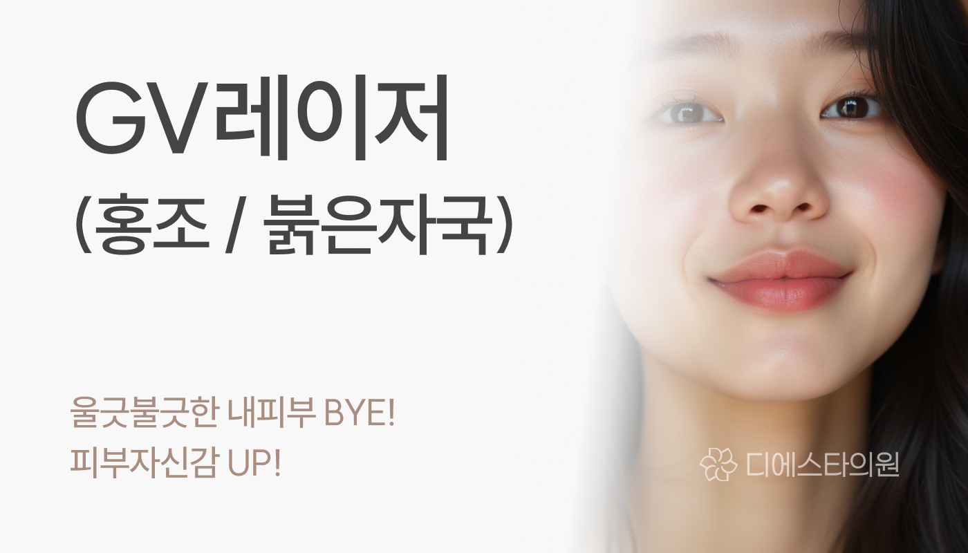 디에스타의원 강동천호점 ::  GV레이저(홍조,붉은자국)