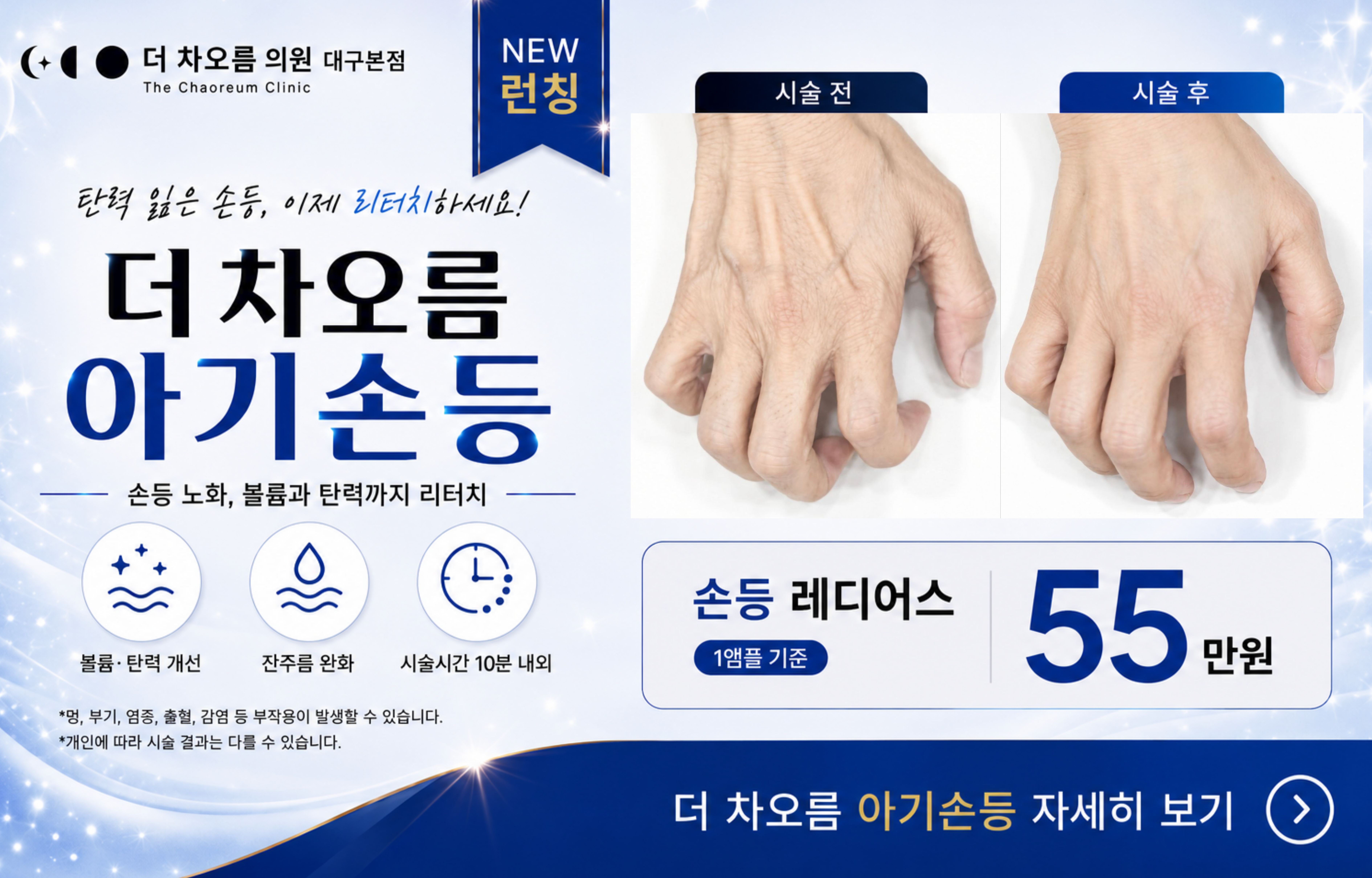 ✨더차오름 아기손등✨