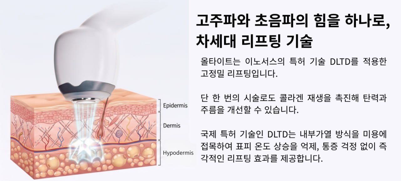 더 차오름의원 :: 올타이트 리프팅