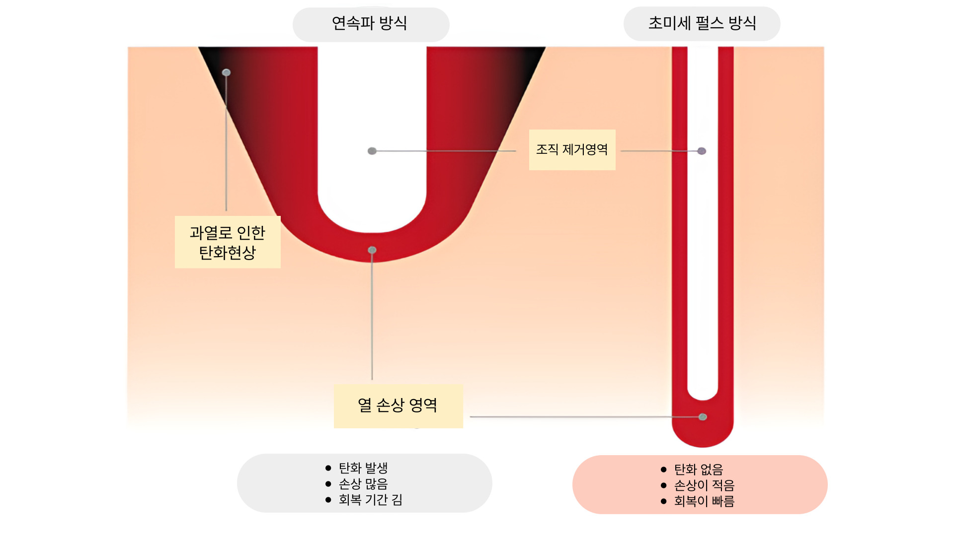 더 차오름의원 :: 울트라펄스 레이저 