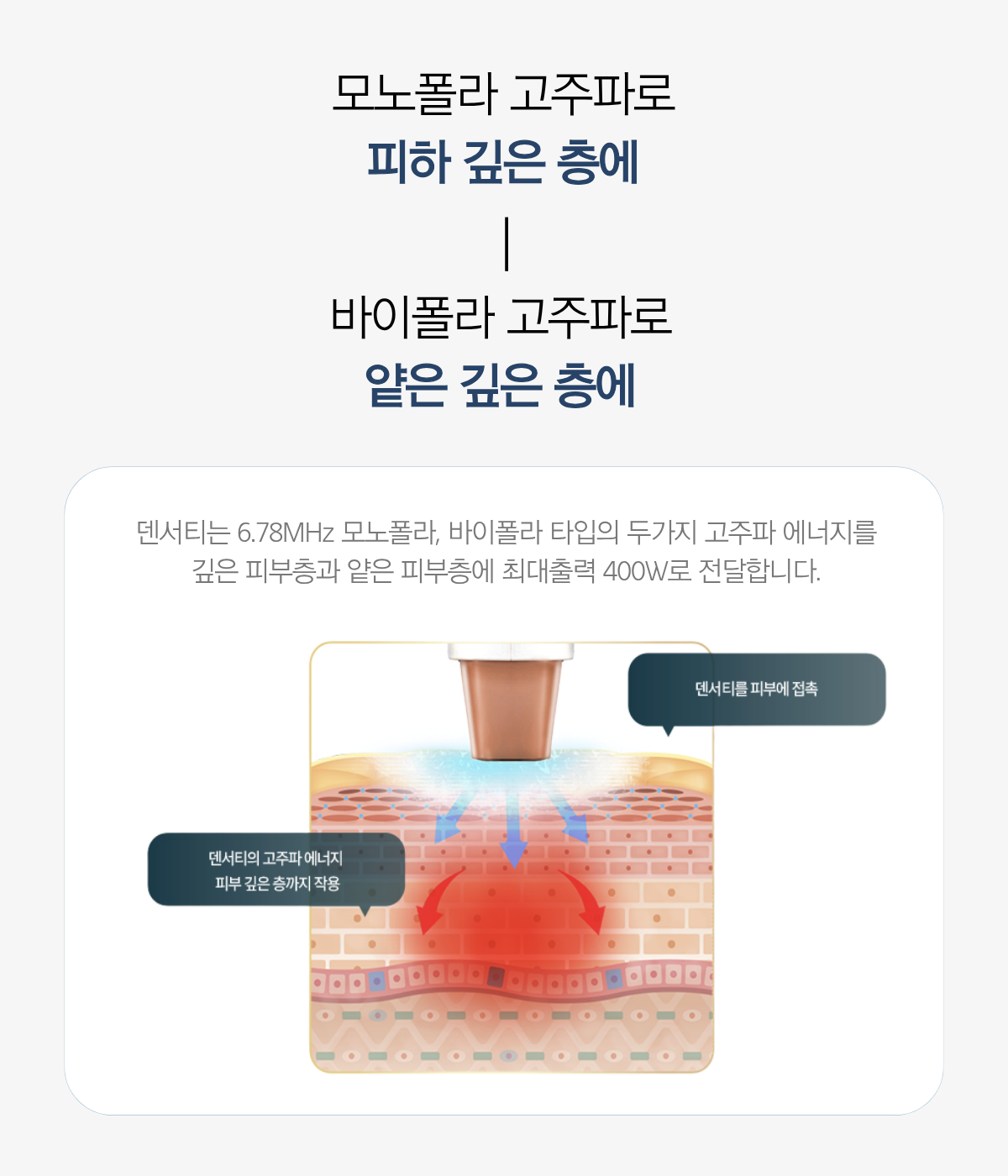 더 차오름의원 :: 덴서티