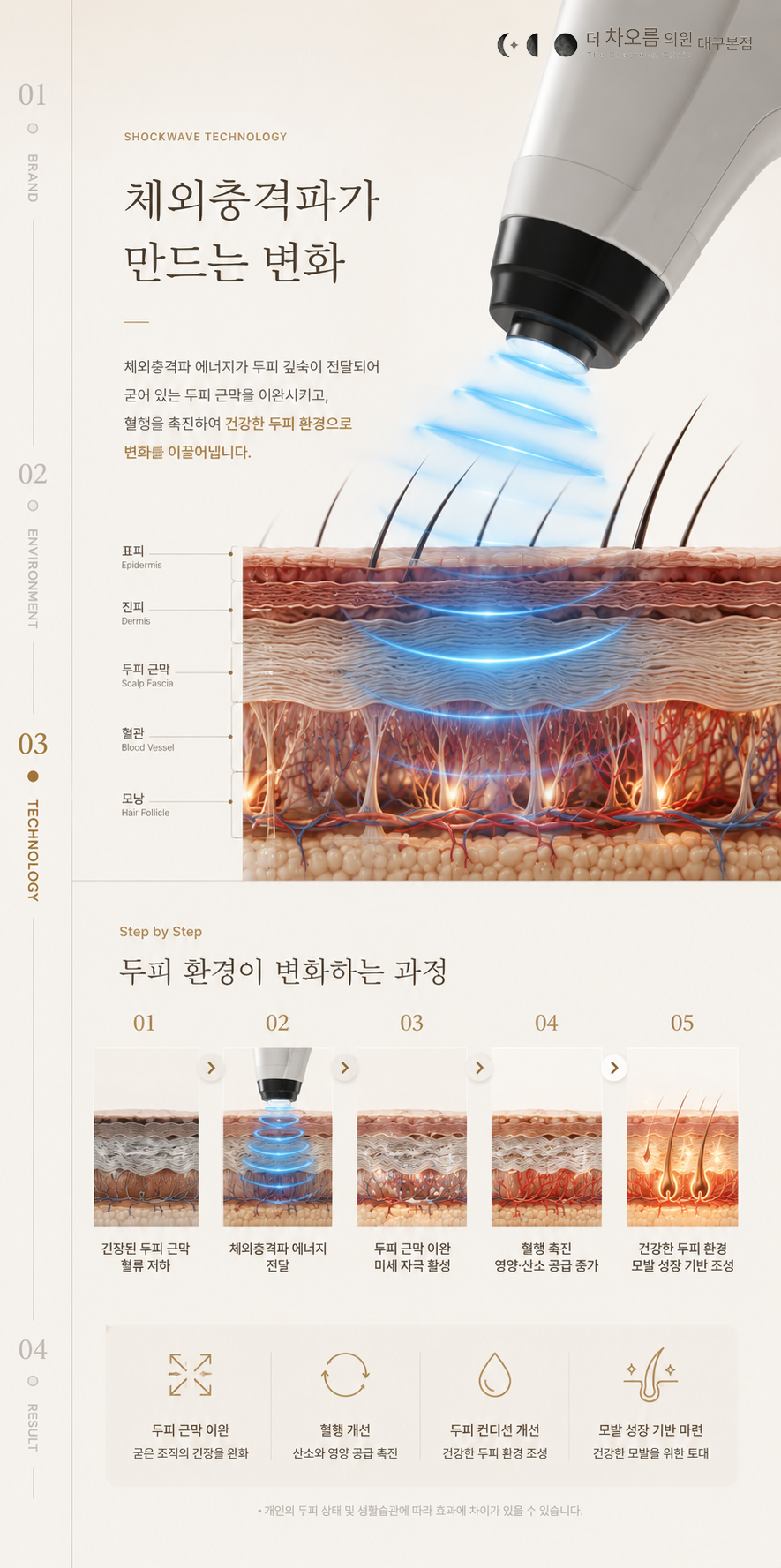 더 차오름의원 :: 두피근막충격파관리