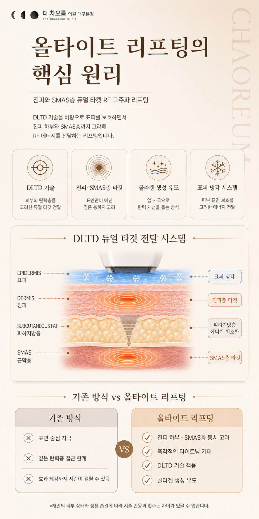 더 차오름의원 :: 올타이트 리프팅