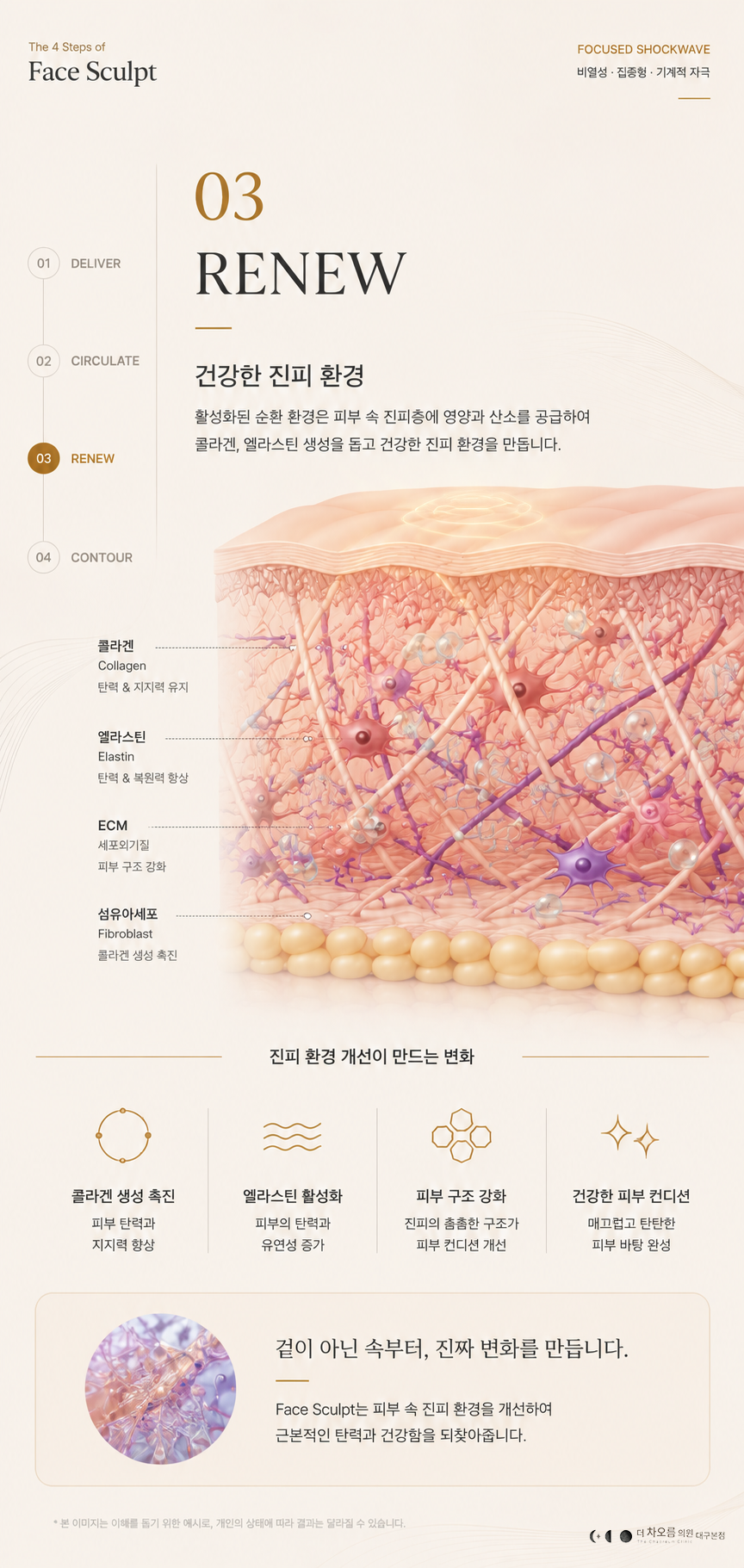 더 차오름의원 :: 얼굴근막 리프팅관리