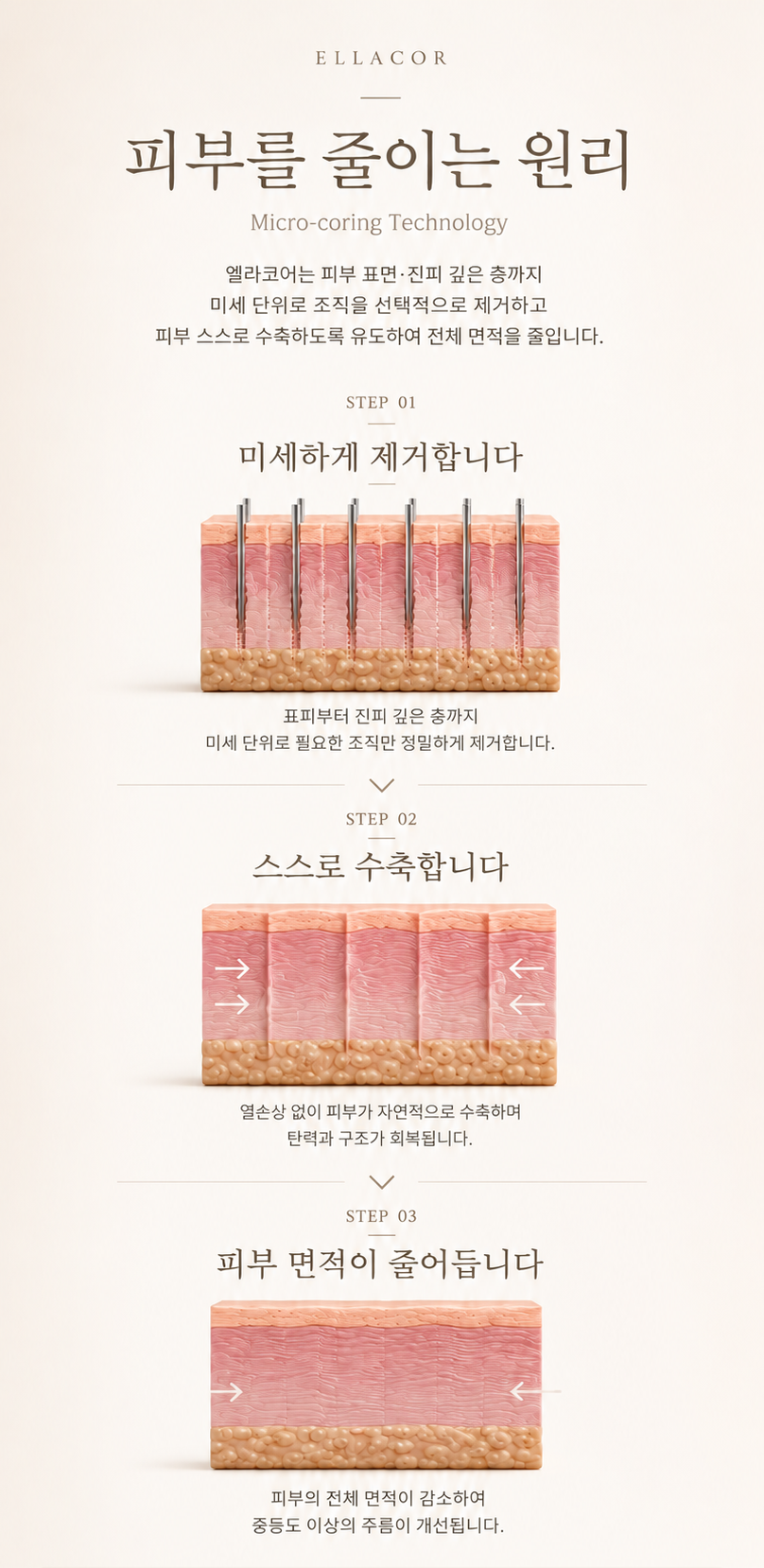 더 차오름의원 :: 엘라코어