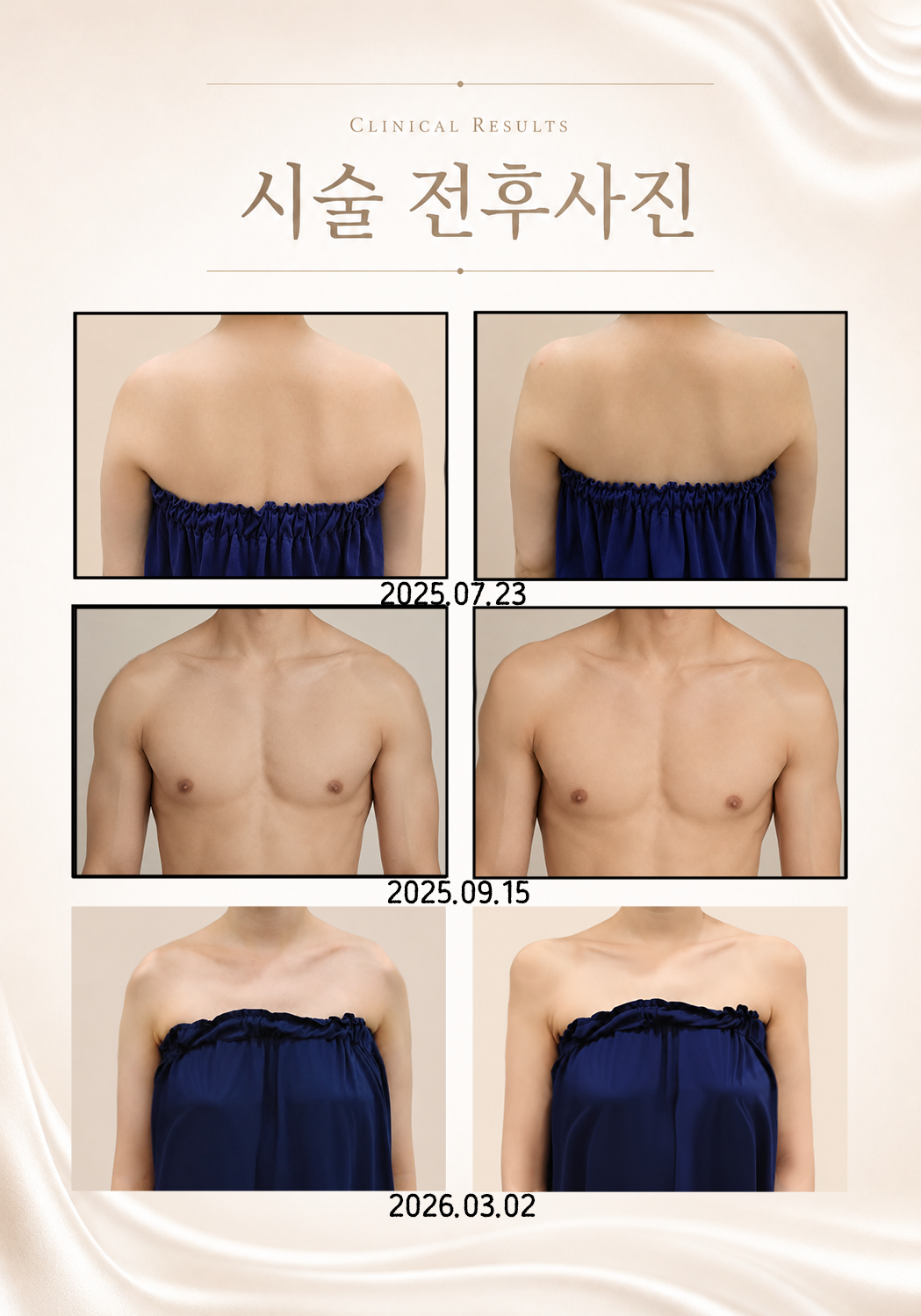 더 차오름의원 :: 어깨필러