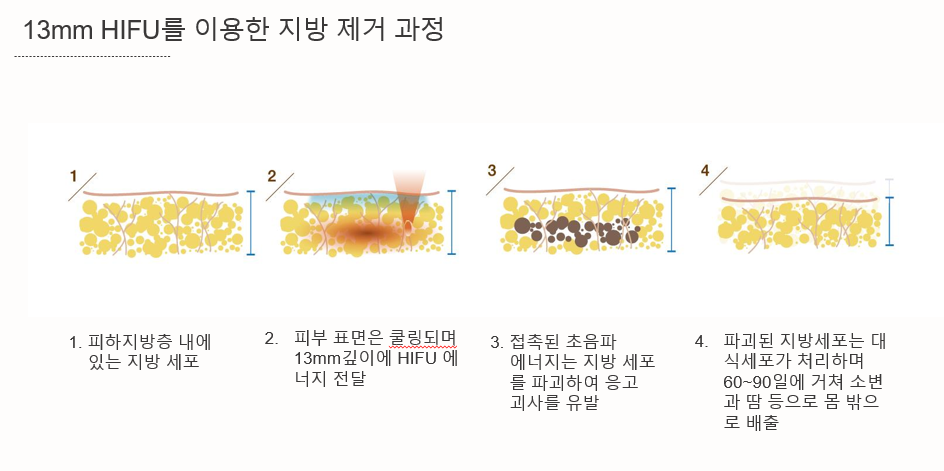 더 차오름의원 :: 사이저