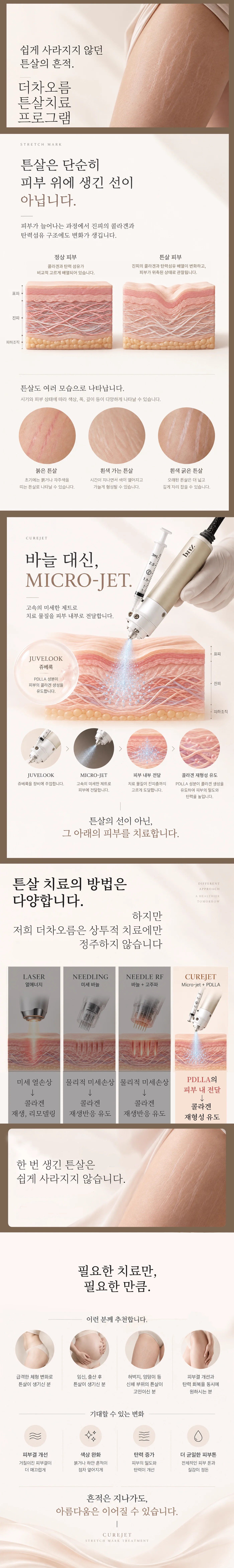 대구피부과 더차오름의원 대구본점 :: 더차오름 튼살치료 프로그램