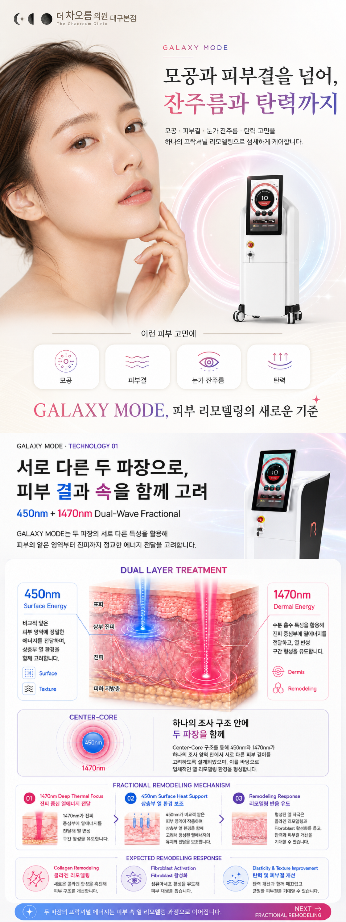 더 차오름의원 :: 갤럭시 레이저 (갤럭시 모드)