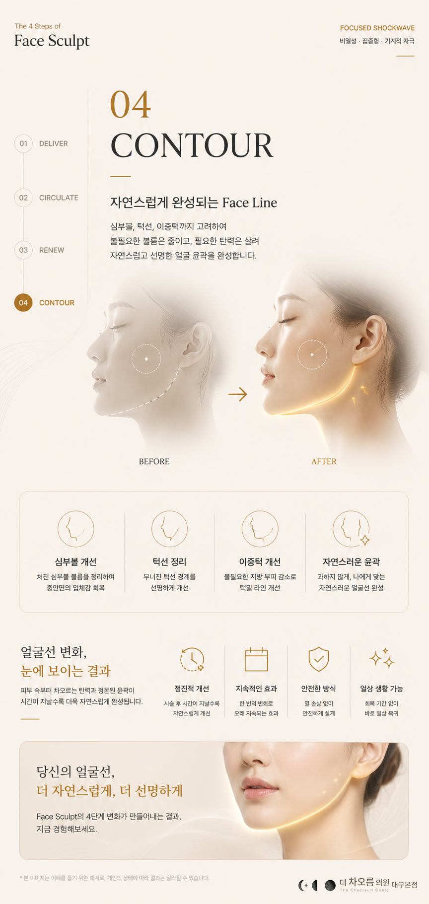 더 차오름의원 :: 얼굴근막 리프팅관리